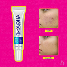 Cargar imagen en el visor de la galería, BIOAQUA Crema Anti Acne Pure Skin Cicatrices Control Grasa OnlyShop Mexico
